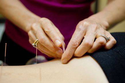 Dubbo Acupuncture & Carter Chiropractic - Renee 1