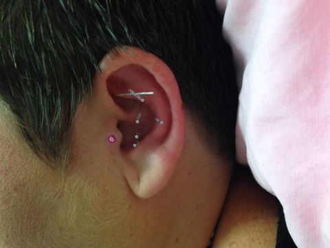 Acupuncture @ Beerwah - Renee 3