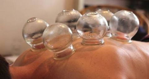 Acupuncture @ Beerwah - Renee 4