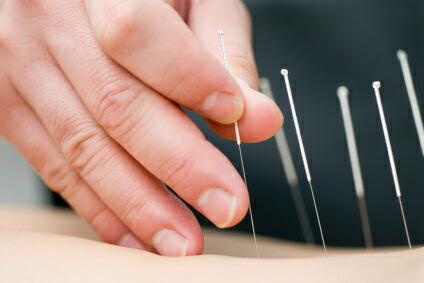 Kingscliff Acupuncture & Massage - Renee 0