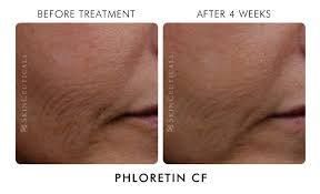 Palmerston Day Spa - Renee 3