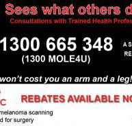 Advanced Mole Clinic - Renee