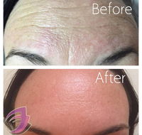 Evolve Medical Aesthetics Weight Loss - Petrol Stations