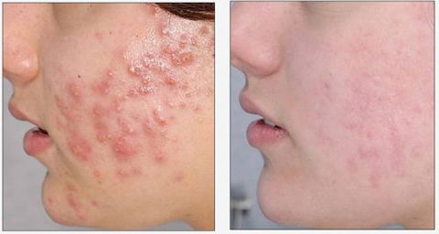 Skinworx Skin Cosmetic & Wellness Centre - Internet Find 4