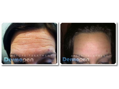 Skinworx Skin Cosmetic & Wellness Centre - Internet Find 5