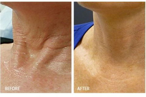 Skinworx Skin Cosmetic & Wellness Centre - Internet Find 11