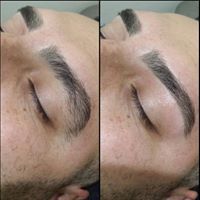 Oh Darling Skin & Beauty Bar - Renee 11