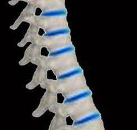 Glasco Chiropractic - Renee