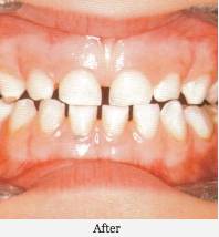 Cairns Dental Anaesthetic Centre - Renee 3