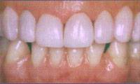Cairns Dental Anaesthetic Centre - Renee 4