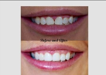 A+ Family Dental - Swimm 4