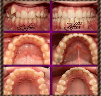 Coral Coast Dental - Renee