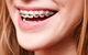 Cairns Specialist Orthodontists - thumb 0