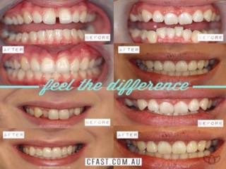 Fresh Dental Care - Renee 6