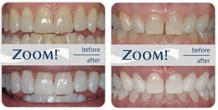 Arthur Street Dental Surgery - Renee 2