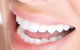 Ramana Harry–Dental Prosthetist - thumb 0