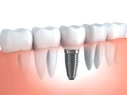 McDonald Dental - Renee 3