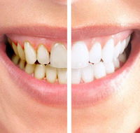 Graham Johnson Dental Surgeon - Renee