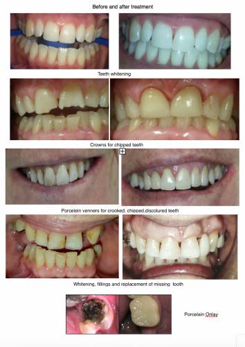 Smile Craft Dental - Swimm 0