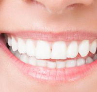 MS Dental Cardiff - Renee