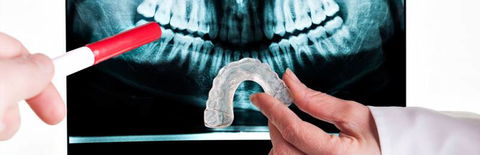 Hilliar Bruce Dr Dentist - Renee 4