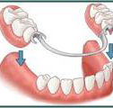 Denture Success - Renee