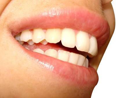Affordable Dental Care - Renee 3