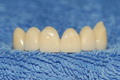 Watkins Dental - Renee 4