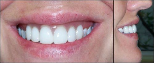 Denture Clinics Lismore NSW Renee