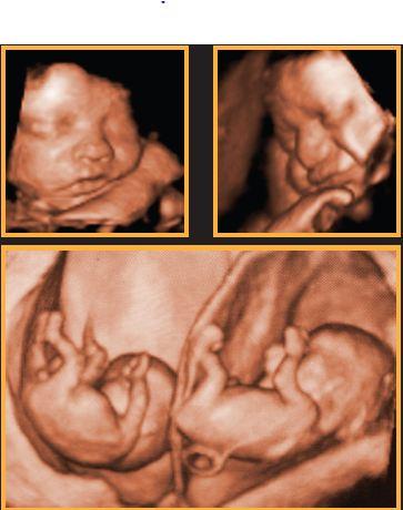 Sarina Medical Imaging - Internet Find 0