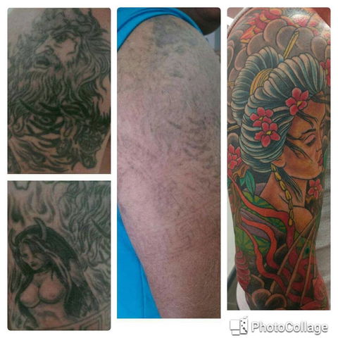 Laserpro Tattoo Removal - Petrol Stations 0