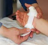 Central Coast Hand  Upper Limb Therapy - Renee