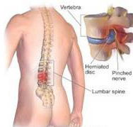 Michael Marsden Chiropractor - Renee