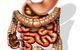 Colonics–Colon Hydrotherapy - thumb 3