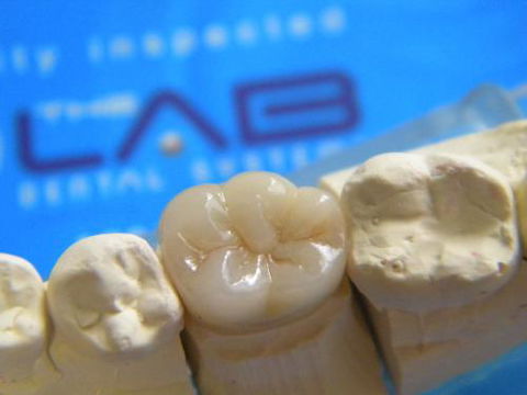 The Lab Dental Systems - Renee 0