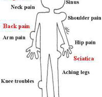 Mark JonesRemedial  Sports Massage Therapy - Renee