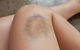 Medowie Physiotherapy & Sports Injuries Centre - thumb 3