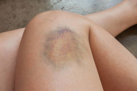 Medowie Physiotherapy & Sports Injuries Centre - Internet Find 3