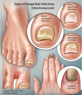 Port Stephens Podiatry - Renee 2