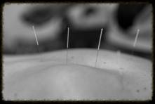 The Clinic Osteopathy & Dry Needling - Swimm 3