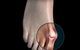 Beyond Podiatry - thumb 2