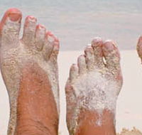 Innovation Podiatry - Renee